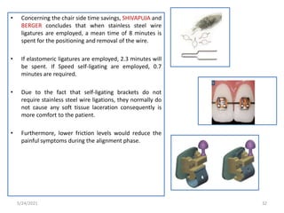 • Concerning the chair side time savings, SHIVAPUJA and
BERGER concludes that when stainless steel wire
ligatures are employed, a mean time of 8 minutes is
spent for the positioning and removal of the wire.
• If elastomeric ligatures are employed, 2.3 minutes will
be spent. If Speed self-ligating are employed, 0.7
minutes are required.
• Due to the fact that self-ligating brackets do not
require stainless steel wire ligations, they normally do
not cause any soft tissue laceration consequently is
more comfort to the patient.
• Furthermore, lower friction levels would reduce the
painful symptoms during the alignment phase.
5/24/2021 32
 