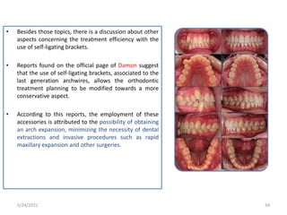 • Besides those topics, there is a discussion about other
aspects concerning the treatment efficiency with the
use of self-ligating brackets.
• Reports found on the official page of Damon suggest
that the use of self-ligating brackets, associated to the
last generation archwires, allows the orthodontic
treatment planning to be modified towards a more
conservative aspect.
• According to this reports, the employment of these
accessories is attributed to the possibility of obtaining
an arch expansion, minimizing the necessity of dental
extractions and invasive procedures such as rapid
maxillary expansion and other surgeries.
5/24/2021 34
 