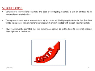 5.HIGHER COST:
• Compared to conventional brackets, the cost of self-ligating brackets is still an obstacle to its
increased commercialization.
• The arguments used by the manufacturers try to counteract this higher price with the fact that there
will be no expenses with elastomeric ligatures which are not needed with the self-ligating brackets.
• However, it must be admitted that this convenience cannot be justified due to the small prices of
those ligatures in the market.
5/24/2021 39
 
