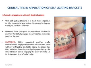 CLINICAL TIPS IN APPLICATION OF SELF LIGATING BRACKETS
1.Archwire engagement with self-ligating brackets
• With self-ligating brackets, it is much more important
to fully engage the wire before clip closure by ligature
tucker, or Mitchell’s trimmer.
• However, these only push on one side of the bracket
and may fail to fully engage the wire across the whole
width of the slot.
• HARRADINE, 2003, suggested another useful
manoeuvre to engage very rotated or displaced tooth
with any self-ligating bracket by closing the clip or slide
first, and then threading the aligning wire through the
closed bracket before engaging the other brackets, i.e.
to first convert it to a ‘molar’ tube.
5/24/2021 40
 