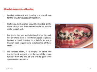 8.Bracket placement and bonding
• Bracket placement and bonding is a crucial step
for the long-tem success of treatment.
• Preferably, both arches should be bonded at the
same session and from second molar to second
molar in each arch.
• For teeth that are well displaced from the arch
line or where there is insufficient space to place a
bracket in ideal position, it is helpful to use a
traction hook to gain some initial control of these
teeth.
• For rotated teeth, it is helpful to offset the
traction hook so that it is on the part of the crown
furthest from the line of the arch to gain some
spontaneous derotation.
5/24/2021 48
 