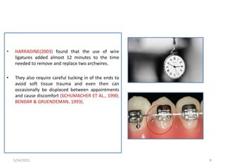 • HARRADINE(2003) found that the use of wire
ligatures added almost 12 minutes to the time
needed to remove and replace two archwires.
• They also require careful tucking in of the ends to
avoid soft tissue trauma and even then can
occasionally be displaced between appointments
and cause discomfort (SCHUMACHER ET AL., 1990;
BENDAR & GRUENDEMAN, 1993).
5/24/2021 8
 