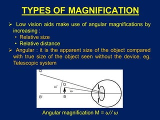 TYPES OF MAGNIFICATION
 Low vision aids make use of angular magnifications by
increasing :
• Relative size
• Relative distance
 Angular : it is the apparent size of the object compared
with true size of the object seen without the device. eg.
Telescopic system
Angular magnification M = ω’/ ω
 