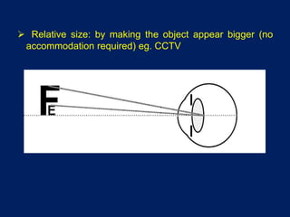  Relative size: by making the object appear bigger (no
accommodation required) eg. CCTV
 