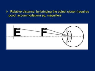  Relative distance: by bringing the object closer (requires
good accommodation) eg. magnifiers
 