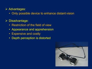  Advantages:
• Only possible device to enhance distant vision
 Disadvantage:
• Restriction of the field of view
• Appearance and apprehension
• Expensive and costly
• Depth perception is distorted
 