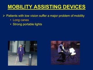 MOBILITY ASSISTING DEVICES
 Patients with low vision suffer a major problem of mobility
• Long canes
• Strong portable lights
 