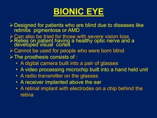 BIONIC EYE
Designed for patients who are blind due to diseases like
retinitis pigmentosa or AMD
Can also be tried for those with severe vision loss
Relies on patient having a healthy optic nerve and a
developed visual cortex
Cannot be used for people who were born blind
The prosthesis consists of :
• A digital camera built into a pair of glasses
• A video processing microchip built into a hand held unit
• A radio transmitter on the glasses
• A receiver implanted above the ear
• A retinal implant with electrodes on a chip behind the
retina
 