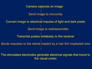 Camera captures an image
Send image to microchip
Convert image to electrical impulse of light and dark pixels
Send image to radiotansmitter
Transmits pulses wirelessly to the receiver
Sends impulses to the retinal implant by a hair thin implanted wire
The stimulated electrodes generate electrical signals that travel to
the visual cortex
 