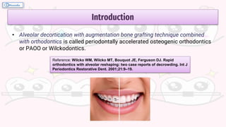 Introduction
• Alveolar decortication with augmentation bone grafting technique combined
with orthodontics is called periodontally accelerated osteogenic orthodontics
or PAOO or Wilckodontics.
Reference: Wilcko WM, Wilcko MT, Bouquot JE, Ferguson DJ. Rapid
orthodontics with alveolar reshaping: two case reports of decrowding. Int J
Periodontics Restorative Dent. 2001;21:9–19.
 