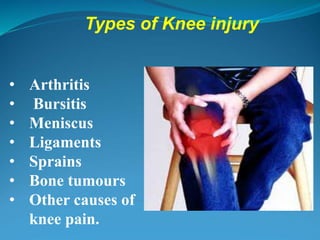 Types of Knee injury
• Arthritis
• Bursitis
• Meniscus
• Ligaments
• Sprains
• Bone tumours
• Other causes of
knee pain.
 