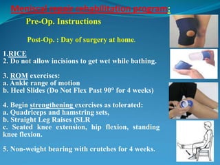 Meniscal repair rehabilitation program:
Post-Op. : Day of surgery at home.
1.RICE
2. Do not allow incisions to get wet while bathing.
3. ROM exercises:
a. Ankle range of motion
b. Heel Slides (Do Not Flex Past 90° for 4 weeks)
4. Begin strengthening exercises as tolerated:
a. Quadriceps and hamstring sets,
b. Straight Leg Raises (SLR
c. Seated knee extension, hip flexion, standing
knee flexion.
5. Non-weight bearing with crutches for 4 weeks.
Pre-Op. Instructions
 