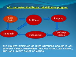 ACL reconstructionRepair rehabilitation program:
THE HIGHEST INCIDENCE OF KNEE STIFFNESS OCCURS IF ACL
SURGERY IS PERFORMED WHEN THE KNEE IS SWOLLEN, PAINFUL,
AND HAS A LIMITED RANGE OF MOTION.
Knee pain
Stiffness
Limping
Quadriceps
wasting
Knee
effusion
Malalignment
 