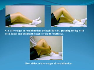 • In later stages of rehabilitation, do heel slides by grasping the leg with
both hands and pulling the heel toward the buttocks.
Heel slides in later stages of rehabilitation
 