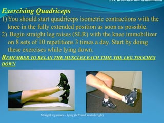 ACL Reconstruction Rehabilitation
Exercising Quadriceps
1)You should start quadriceps isometric contractions with the
knee in the fully extended position as soon as possible.
2) Begin straight leg raises (SLR) with the knee immobilizer
on 8 sets of 10 repetitions 3 times a day. Start by doing
these exercises while lying down.
REMEMBER TO RELAX THE MUSCLES EACH TIME THE LEG TOUCHES
DOWN
Straight leg raises – lying (left) and seated (right)
 