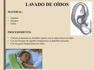 LAVADO DE OÍDOS
MATERIAL:
• Guantes
• Hisopos
• Gasas
PROCEDIMIENTO:
• Colocar al paciente en decúbito supino con la cabeza hacia un lado.
• Con los hisopos de algodón limpiaremos el pabellón auricular.
• Con las gasas limpiaremos los oídos.
 