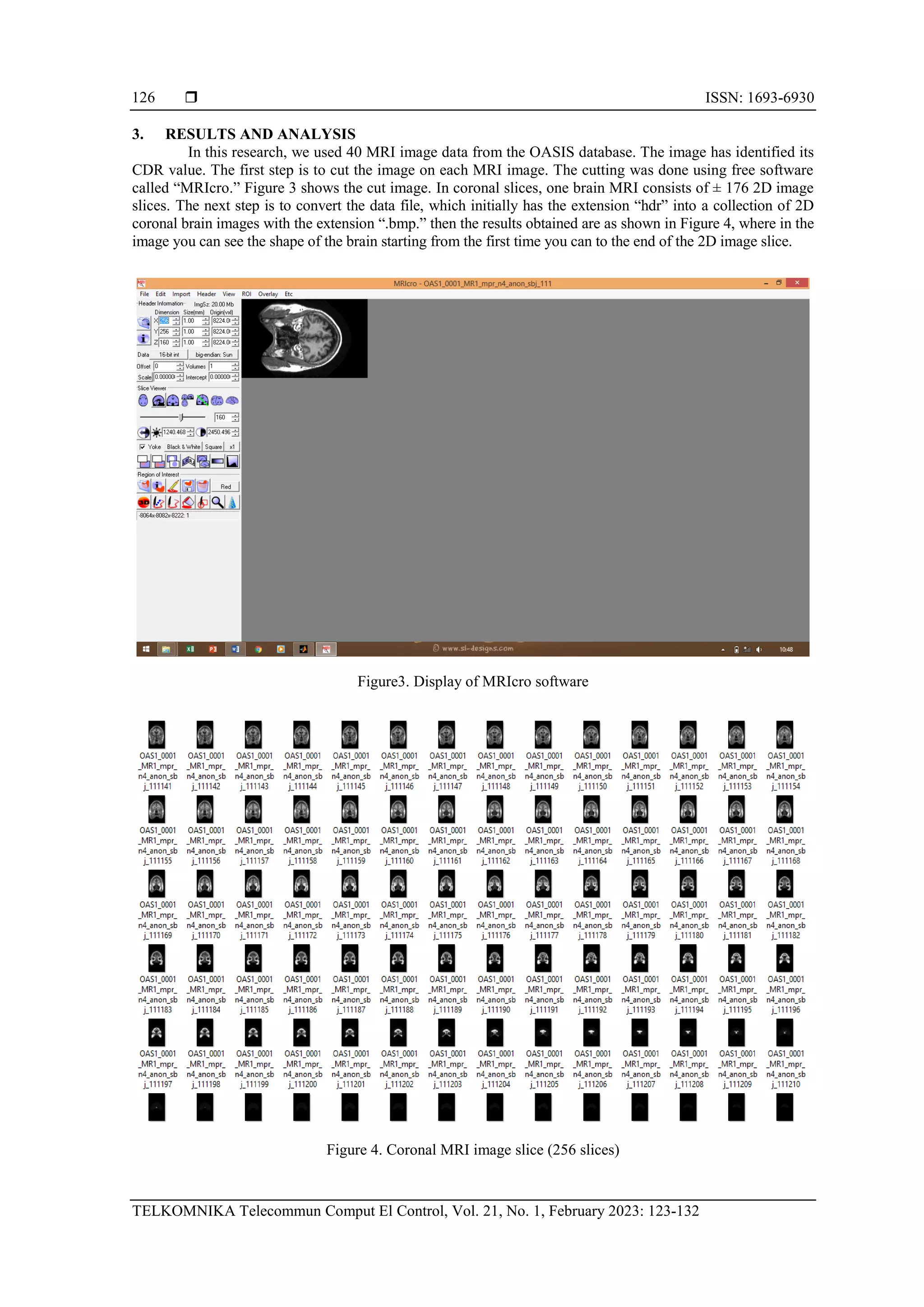  ISSN: 1693-6930
TELKOMNIKA Telecommun Comput El Control, Vol. 21, No. 1, February 2023: 123-132
126
3. RESULTS AND ANALYSIS
In this research, we used 40 MRI image data from the OASIS database. The image has identified its
CDR value. The first step is to cut the image on each MRI image. The cutting was done using free software
called “MRIcro.” Figure 3 shows the cut image. In coronal slices, one brain MRI consists of ± 176 2D image
slices. The next step is to convert the data file, which initially has the extension “hdr” into a collection of 2D
coronal brain images with the extension “.bmp.” then the results obtained are as shown in Figure 4, where in the
image you can see the shape of the brain starting from the first time you can to the end of the 2D image slice.
Figure3. Display of MRIcro software
Figure 4. Coronal MRI image slice (256 slices)
 