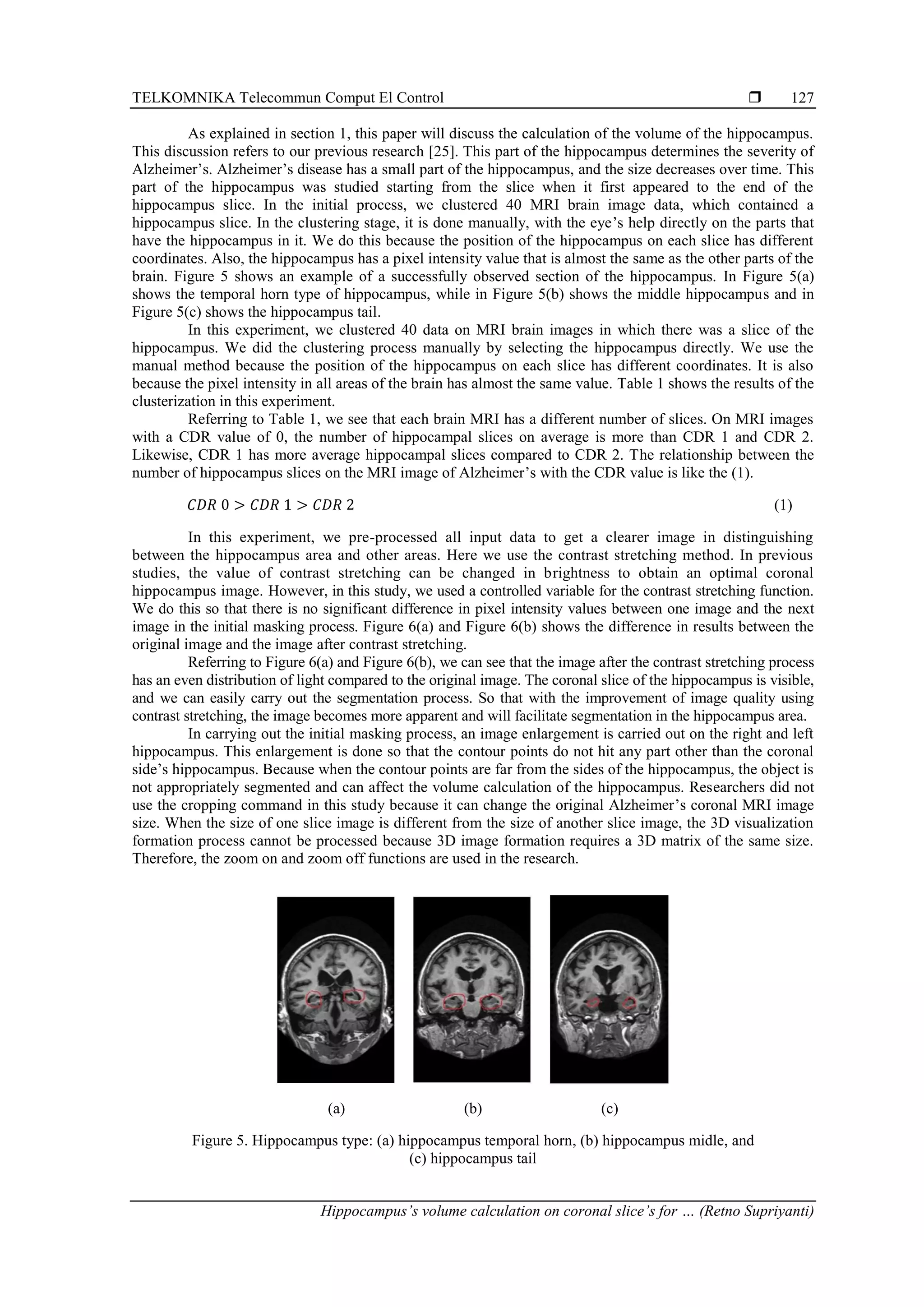 TELKOMNIKA Telecommun Comput El Control 
Hippocampus’s volume calculation on coronal slice’s for … (Retno Supriyanti)
127
As explained in section 1, this paper will discuss the calculation of the volume of the hippocampus.
This discussion refers to our previous research [25]. This part of the hippocampus determines the severity of
Alzheimer’s. Alzheimer’s disease has a small part of the hippocampus, and the size decreases over time. This
part of the hippocampus was studied starting from the slice when it first appeared to the end of the
hippocampus slice. In the initial process, we clustered 40 MRI brain image data, which contained a
hippocampus slice. In the clustering stage, it is done manually, with the eye’s help directly on the parts that
have the hippocampus in it. We do this because the position of the hippocampus on each slice has different
coordinates. Also, the hippocampus has a pixel intensity value that is almost the same as the other parts of the
brain. Figure 5 shows an example of a successfully observed section of the hippocampus. In Figure 5(a)
shows the temporal horn type of hippocampus, while in Figure 5(b) shows the middle hippocampus and in
Figure 5(c) shows the hippocampus tail.
In this experiment, we clustered 40 data on MRI brain images in which there was a slice of the
hippocampus. We did the clustering process manually by selecting the hippocampus directly. We use the
manual method because the position of the hippocampus on each slice has different coordinates. It is also
because the pixel intensity in all areas of the brain has almost the same value. Table 1 shows the results of the
clusterization in this experiment.
Referring to Table 1, we see that each brain MRI has a different number of slices. On MRI images
with a CDR value of 0, the number of hippocampal slices on average is more than CDR 1 and CDR 2.
Likewise, CDR 1 has more average hippocampal slices compared to CDR 2. The relationship between the
number of hippocampus slices on the MRI image of Alzheimer’s with the CDR value is like the (1).
𝐶𝐷𝑅 0 > 𝐶𝐷𝑅 1 > 𝐶𝐷𝑅 2 (1)
In this experiment, we pre-processed all input data to get a clearer image in distinguishing
between the hippocampus area and other areas. Here we use the contrast stretching method. In previous
studies, the value of contrast stretching can be changed in brightness to obtain an optimal coronal
hippocampus image. However, in this study, we used a controlled variable for the contrast stretching function.
We do this so that there is no significant difference in pixel intensity values between one image and the next
image in the initial masking process. Figure 6(a) and Figure 6(b) shows the difference in results between the
original image and the image after contrast stretching.
Referring to Figure 6(a) and Figure 6(b), we can see that the image after the contrast stretching process
has an even distribution of light compared to the original image. The coronal slice of the hippocampus is visible,
and we can easily carry out the segmentation process. So that with the improvement of image quality using
contrast stretching, the image becomes more apparent and will facilitate segmentation in the hippocampus area.
In carrying out the initial masking process, an image enlargement is carried out on the right and left
hippocampus. This enlargement is done so that the contour points do not hit any part other than the coronal
side’s hippocampus. Because when the contour points are far from the sides of the hippocampus, the object is
not appropriately segmented and can affect the volume calculation of the hippocampus. Researchers did not
use the cropping command in this study because it can change the original Alzheimer’s coronal MRI image
size. When the size of one slice image is different from the size of another slice image, the 3D visualization
formation process cannot be processed because 3D image formation requires a 3D matrix of the same size.
Therefore, the zoom on and zoom off functions are used in the research.
(a) (b) (c)
Figure 5. Hippocampus type: (a) hippocampus temporal horn, (b) hippocampus midle, and
(c) hippocampus tail
 