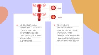 ■ La mucosa vaginal
responde a la infección
con una reacción
inflamatoria que se
caracteriza por el daño
a las células
sup...