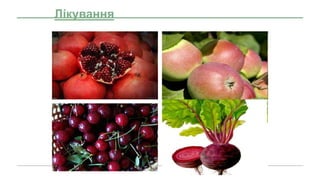 Лікування
 