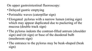 14. Hypertrophic Pyloric Stenosis. pptx | PPTX
