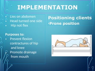 IMPLEMENTATION
Positioning clients
•Prone position
•
•
•
Lies on abdomen
Head turned one side
Hip not flex
Purposes to:
•
•
Prevent flexion
contractures of hip
and knee
Promote drainage
from mouth
54
 