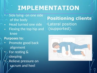 IMPLEMENTATION
Positioning clients
•Lateral position
(supported).
•
•
• Side lying- on one side
of the body
Head turned one side
Flexing the top hip and
knee
Purposes to:
• Promote good back
alignment
• For resting &
sleeping
• Relieve pressure on
sacrum and heel
55
 