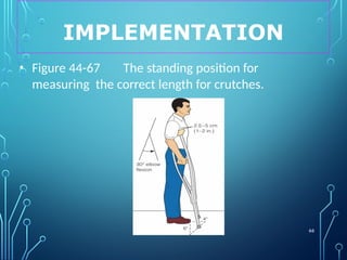 IMPLEMENTATION
66
• Figure 44-67 The standing position for
measuring the correct length for crutches.
 