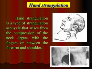 Strangulation Accessory Finger Comprehensive Overview of Mechanical Asphyxia: Types, Causes, and ...