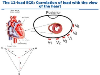 The 12-lead ECG: Correlation of lead with the view
of the heart
 