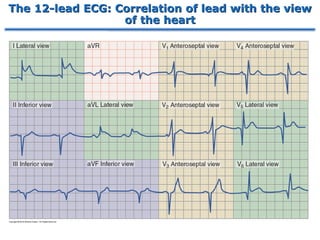 The 12-lead ECG: Correlation of lead with the view
of the heart
 