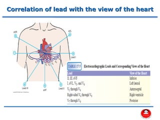 Correlation of lead with the view of the heart
 