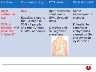 Types of MI
Location Coronary artery ECG leads Clinical impact
Right
ventricular
wall
50% of
patients will
have also
inferior MI
RCA
Supplies blood to
the SA node in
50% of people
and the AV node
in 90% of people
right precordial
chest leads
(RV1 through
RV6)
Q waves and
ST segment
elevations
Some
hemodynamic
changes
Potential for
significant
arrhythmias
caused by SA
and AV node
dysfunction
 