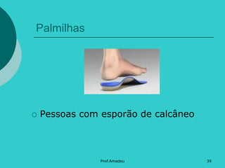 Palmilhas



Pessoas com esporão de calcâneo

Prof.Amadeu

39

 