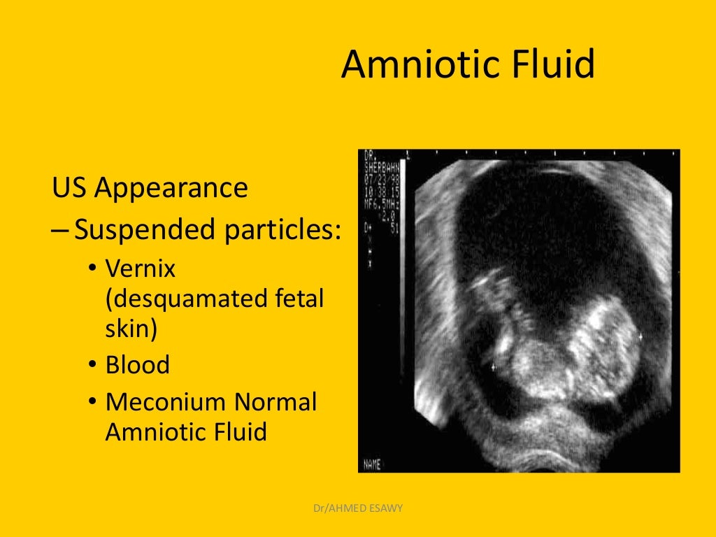 14amniotic fluid imaging Dr Ahmed Esawy