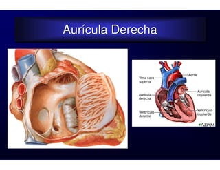 Aurícula Derecha
Aurícula Derecha
 