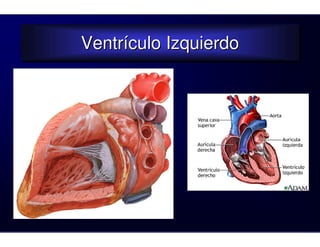 Ventrículo Izquierdo
Ventrículo Izquierdo
 