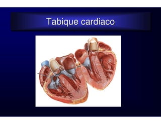 Tabique cardiaco
Tabique cardiaco
 