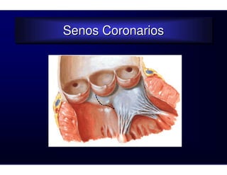Senos Coronarios
Senos Coronarios
 