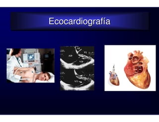Ecocardiografía
Ecocardiografía
 