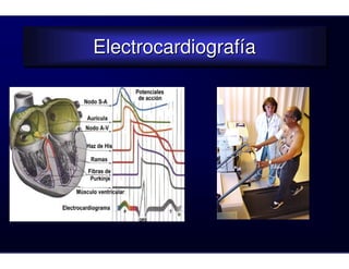 Electrocardiografía
Electrocardiografía
 