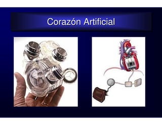 Corazón Artificial
Corazón Artificial
 