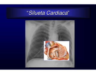 “Silueta Cardiaca”
“Silueta Cardiaca”
 