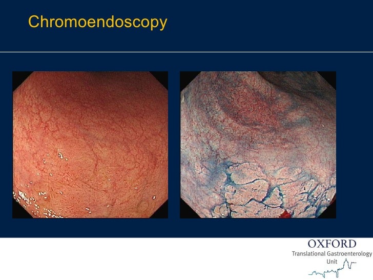 Endoscopy in Gastrointestinal Oncology Slide 14 J. East Endosco…