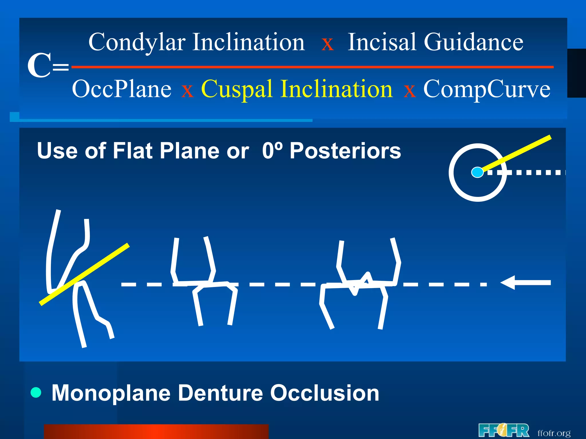 Monoplane Denture Occlusion C = Condylar Inclination OccPlane x   Incisal Guidance x   Cuspal Inclination x  CompCurve Use of Flat Plane or  0º Posteriors 
