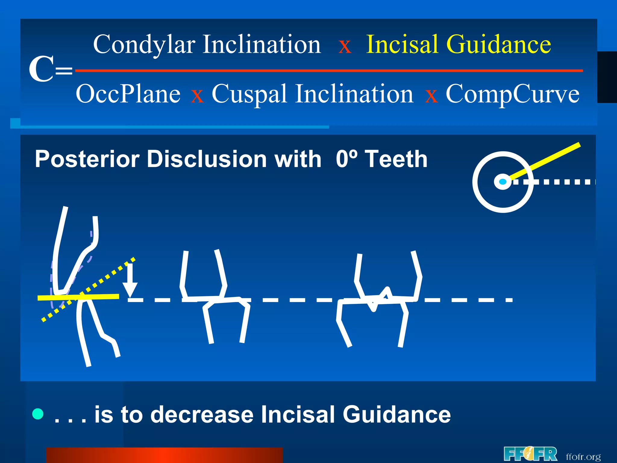 . . . is to decrease Incisal Guidance C = Condylar Inclination OccPlane x   Incisal Guidance x  Cuspal Inclination x  CompCurve Posterior Disclusion with  0º Teeth 