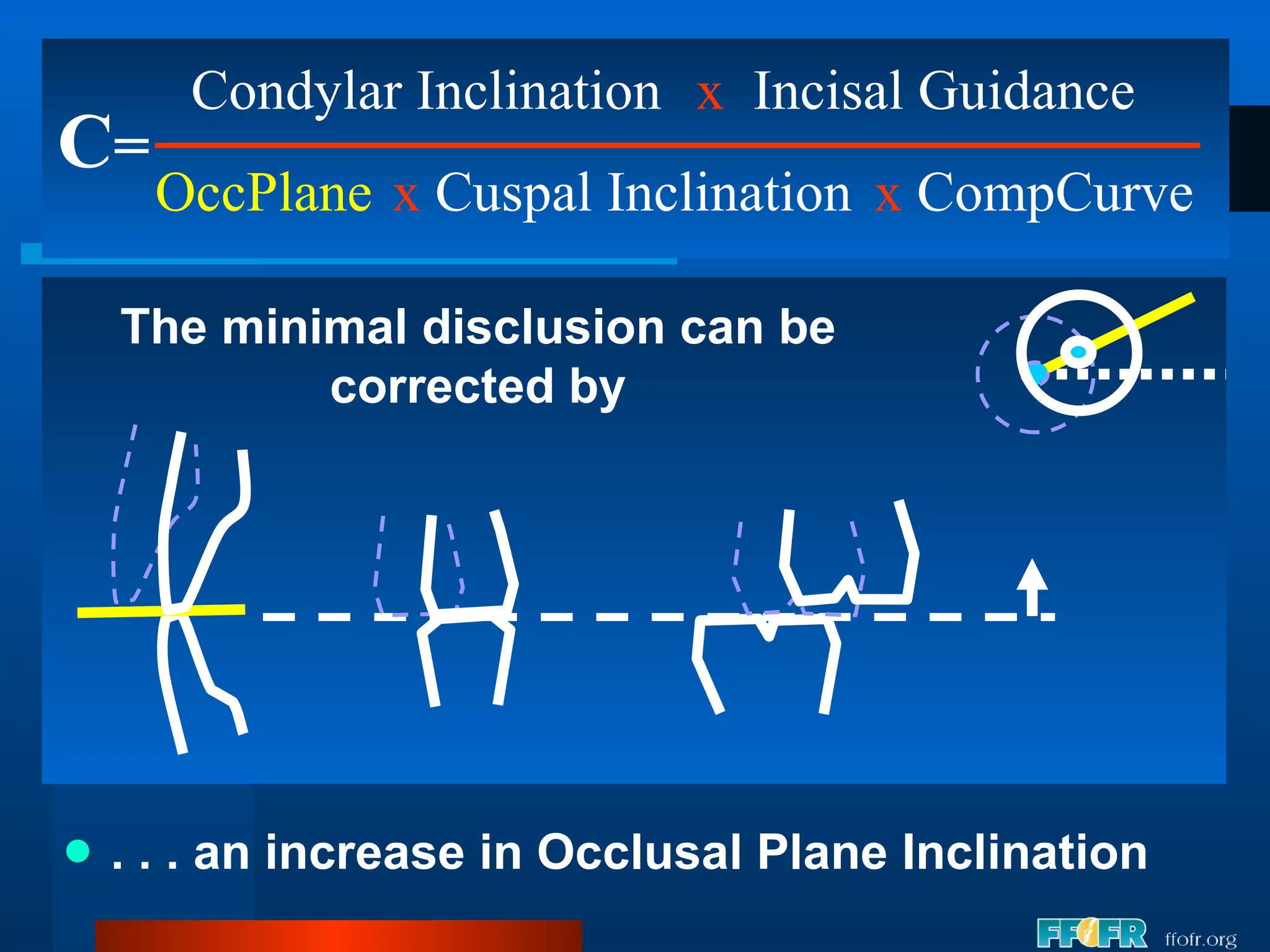. . . an increase in Occlusal Plane Inclination C = Condylar Inclination OccPlane x   Incisal Guidance x  Cuspal Inclination x  CompCurve The minimal disclusion can be corrected by 