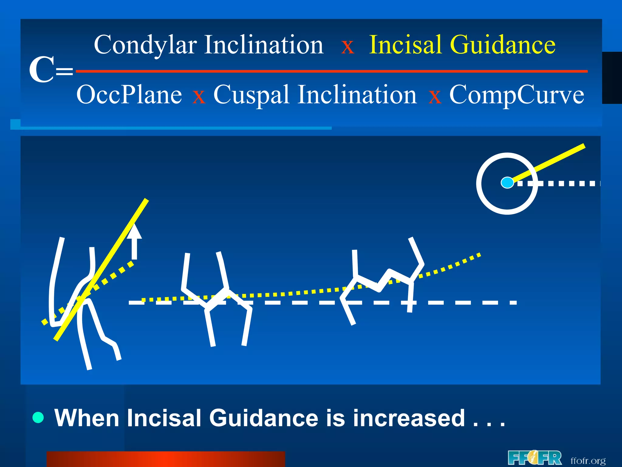 When Incisal Guidance is increased . . . C = Condylar Inclination OccPlane x   Incisal Guidance x  Cuspal Inclination x  CompCurve 