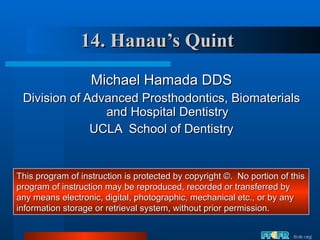 14. Hanau’s Quint ,[object Object],[object Object],[object Object],This program of instruction is protected by copyright ©.  No portion of this program of instruction may be reproduced, recorded or transferred by any means electronic, digital, photographic, mechanical etc., or by any information storage or retrieval system, without prior permission. 