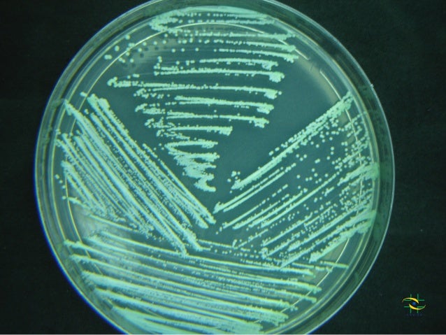 Resultado de imagem para candida cultura